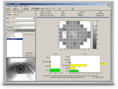 OCULUS perimetry software: Glaucoma Staging Program (GSP)