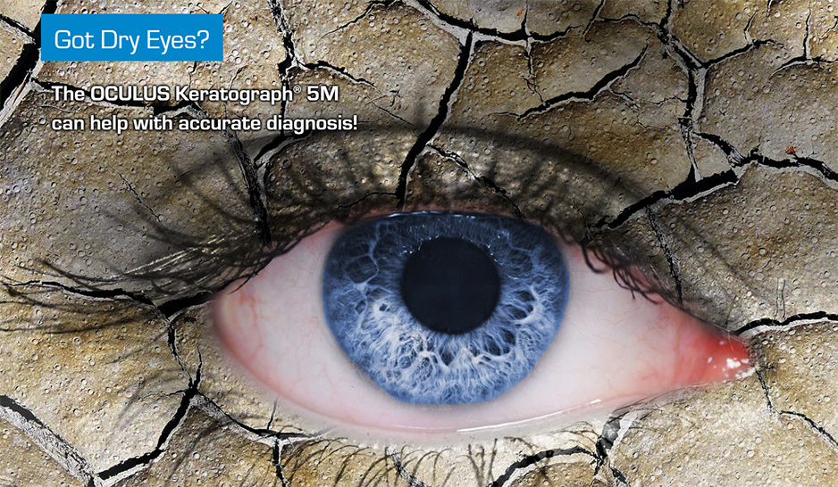 Got Dry Eyes? The OCULUS Keratograph® 5M can help with accurate diagnosis!