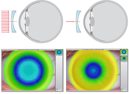 Oxygen transmissibility for a soft contact lens with the spherical power of -3.0 D (left) / -6.0 D (right)